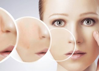 Cilt Lekeleri Neden Olur, Nasıl Geçer? Cilt Lekeleri Nasıl Olur, Nasıl Geçer